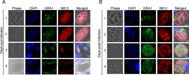 Scientists Have Found The Protein Switch That Drives Widespread Brain Parasite