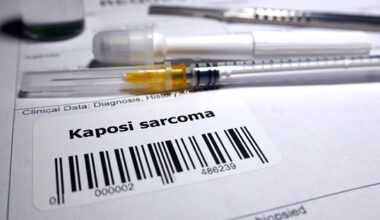 Request for biopsy Kaposi