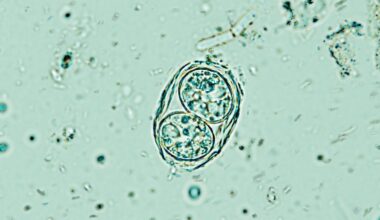 'Off Switch' Discovery Could Help Clear Our Brains of a Common Parasite : ScienceAlert