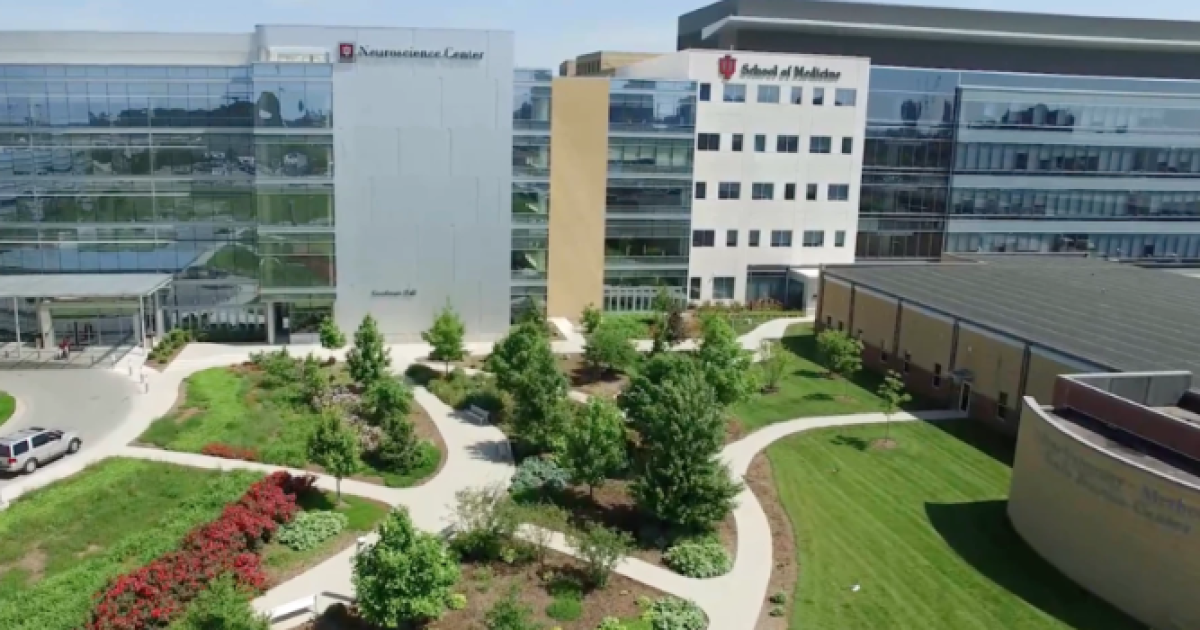 IU researchers identify gene’s role in immune cells that fuel pancreatic cancer