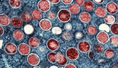 2 cases of possibly more severe mpox strain is confirmed in L.A. County