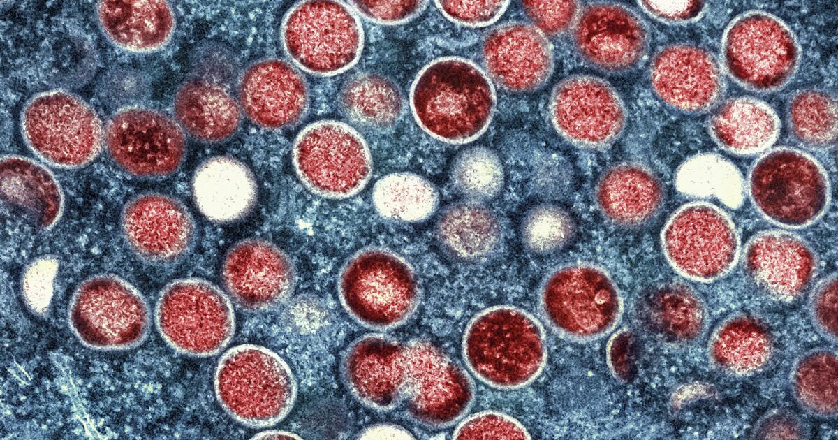 2 cases of possibly more severe mpox strain is confirmed in L.A. County