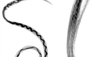 DOH: Rat lungworm disease confirmed in adult on Kauai