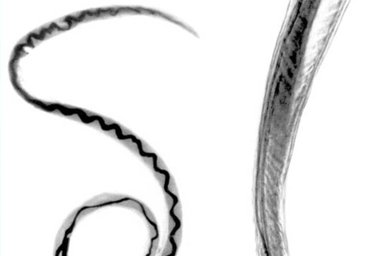 COURTESY PHOTO
                                The rat lungworm parasite is seen through a microscope. The Hawaii Department of Health has confirmed a case of rat lungworm disease in an individual on the island of Kauai.