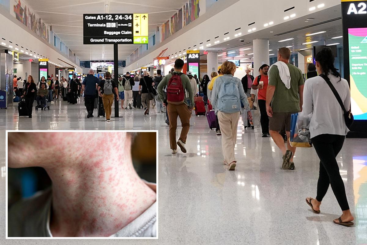 NJ issues health warning after passenger with measles travels through Newark airport