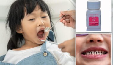 FDA restricts kids’ fluoride supplements over health risks