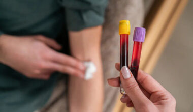 Everyone's buzzing about the blood test that detects 50 types of cancer. I tried it.