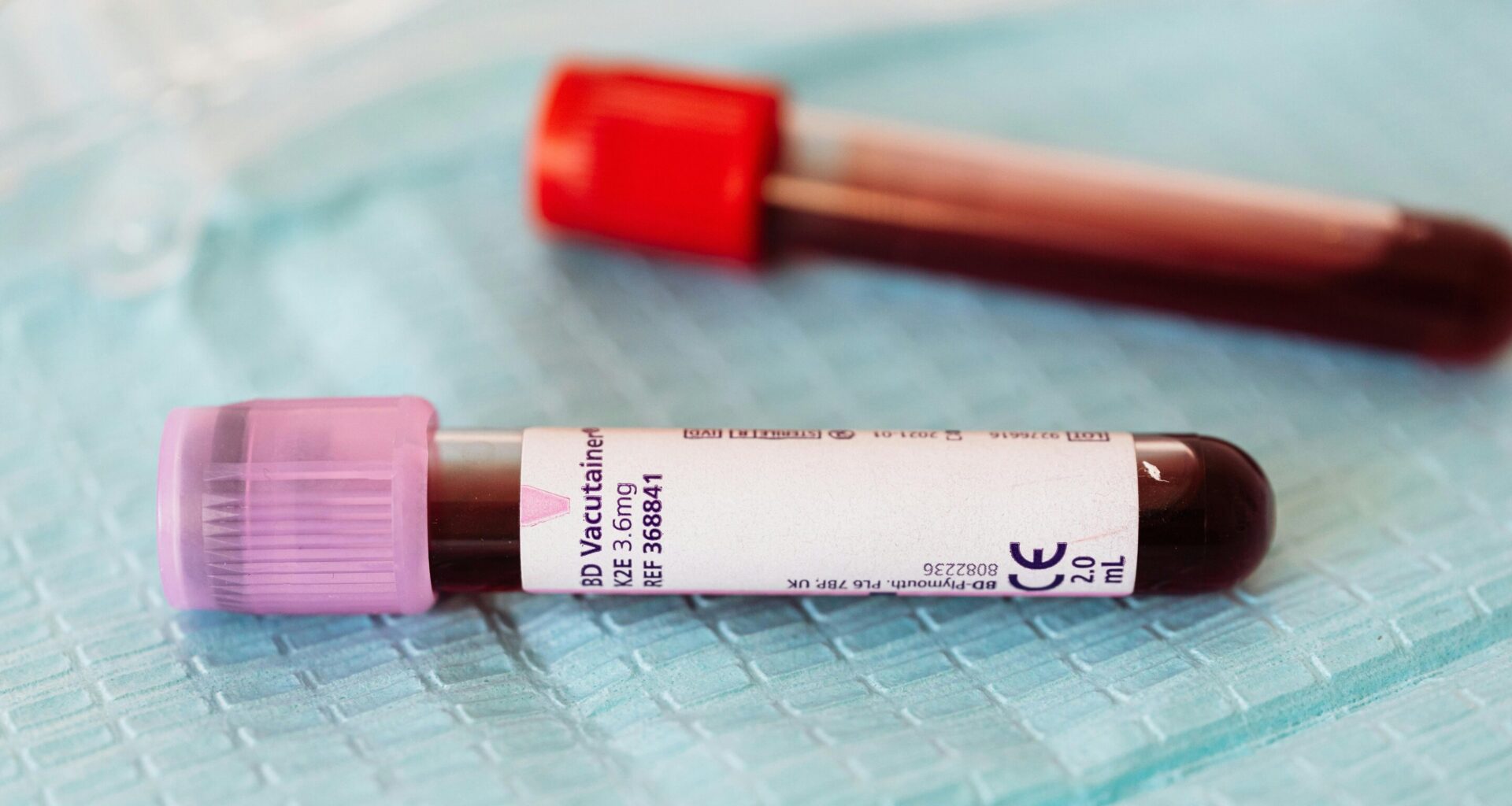 Disagreement between two kidney function tests predicts serious health problems