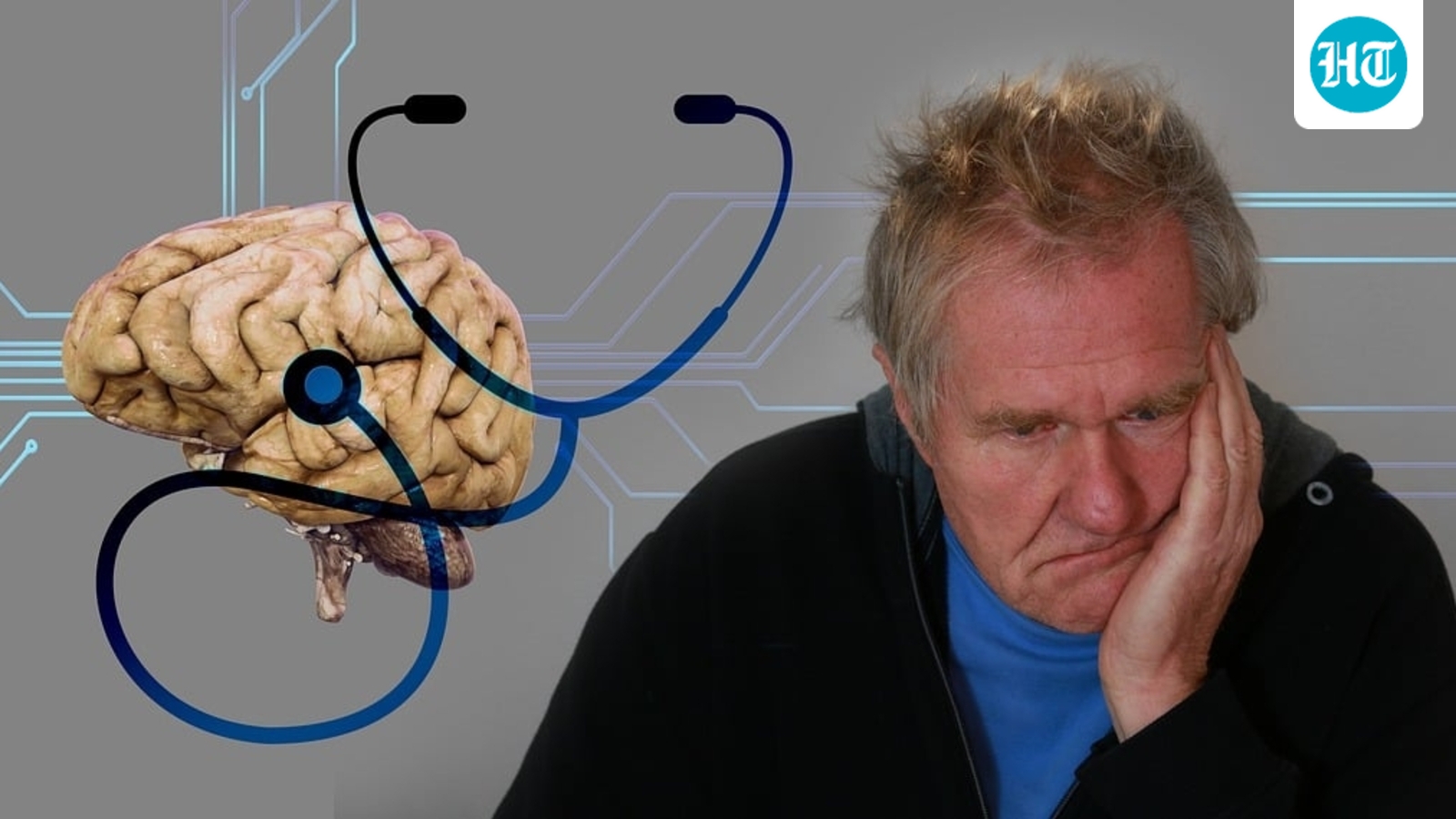 Neuroscientist shares 3 major risk factors for developing Alzheimer's disease: Vitamin deficiency, inflammation, more