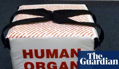 New AI tool could cut wasted efforts to transplant organs by 60% | Organ donation