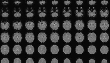 'Mind reading'? Scientist turns mental images into text using AI technology