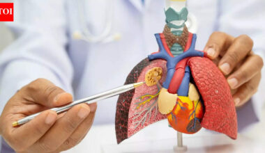 World’s first lung cancer prevention vaccine trial funded with £2.06 million to stop cancer before it starts |