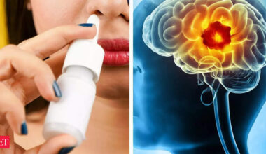 ​US researchers develop nasal spray that can activate immune system to fight against aggressive brain tumors, simply by sniffing​ - Nasal Drops: The Game-Changer