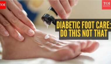 Diabetic foot care: Moisturise here, not there and other tips every blood sugar patient should know