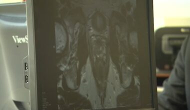 Doctors urging men to take preventative care with health