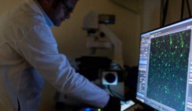 There are more than 100 autoimmune diseases, and they mostly strike women. Here’s what to know - National