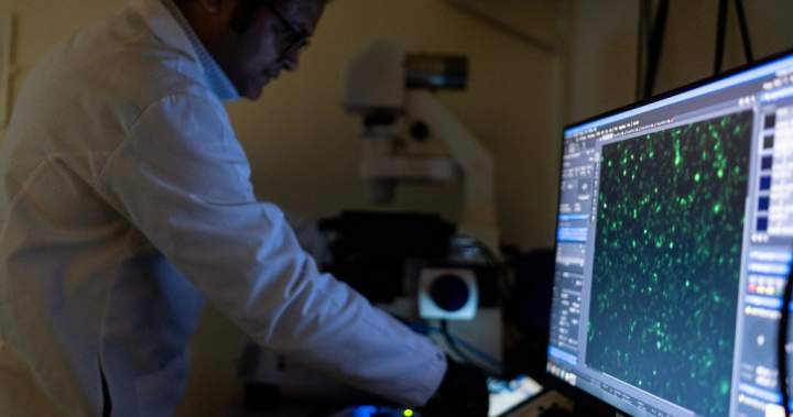 There are more than 100 autoimmune diseases, and they mostly strike women. Here’s what to know - National