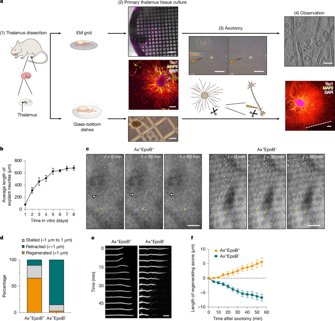 In situ structural mechanism of epothilone-B-induced CNS axon regeneration