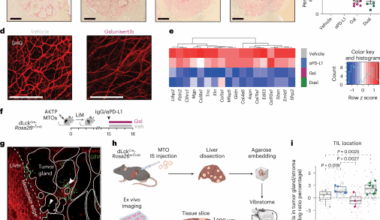 TGF-β builds a dual immune barrier in colorectal cancer by impairing T cell recruitment and instructing immunosuppressive SPP1+ macrophages