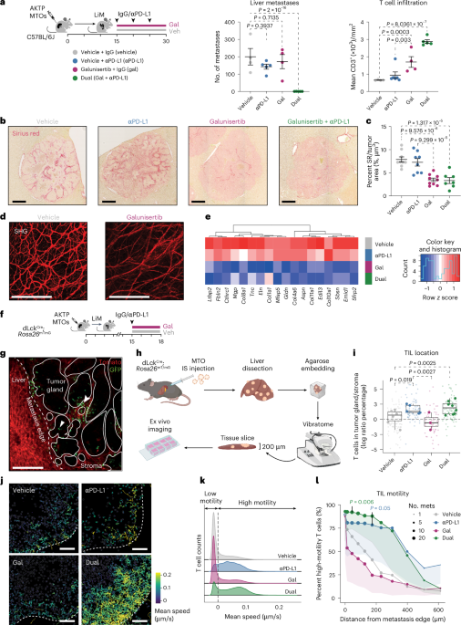TGF-β builds a dual immune barrier in colorectal cancer by impairing T cell recruitment and instructing immunosuppressive SPP1+ macrophages