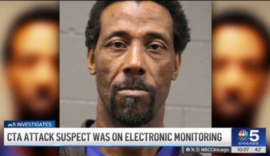 Man accused of setting woman on fire was on electronic monitoring – NBC Chicago