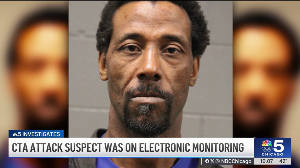 Man accused of setting woman on fire was on electronic monitoring – NBC Chicago