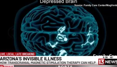 13 News anchor shares experience with TMS depression treatment