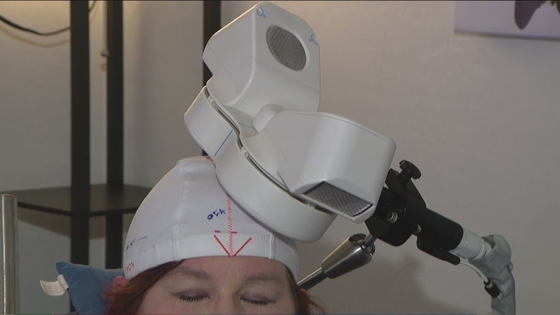 New TMS treatment helps those as young as 15 with severe depression