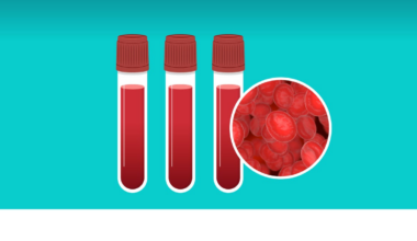 New blood test can detect more than 50 cancers early.