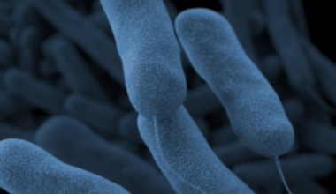 2 cases of Legionnaires’ disease confirmed at Cincinnati hospital