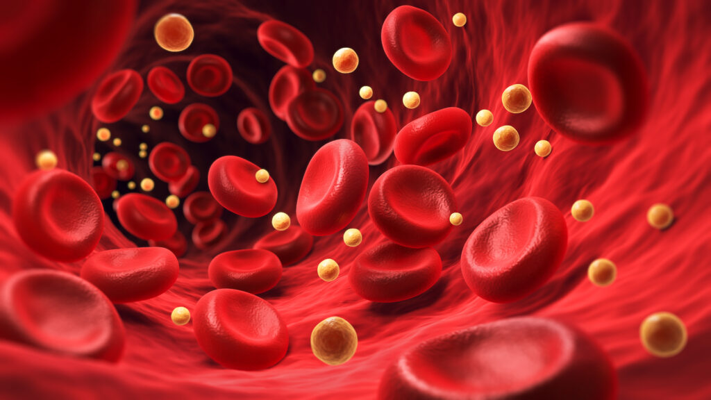 CRISPR gene editing therapy cuts LDL cholesterol in small study