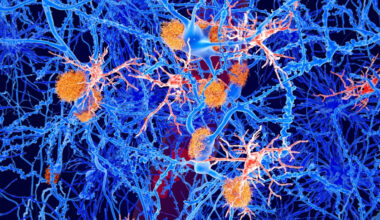 'Young' Immune Cells Partly Reverse Alzheimer's Symptoms in Mice : ScienceAlert