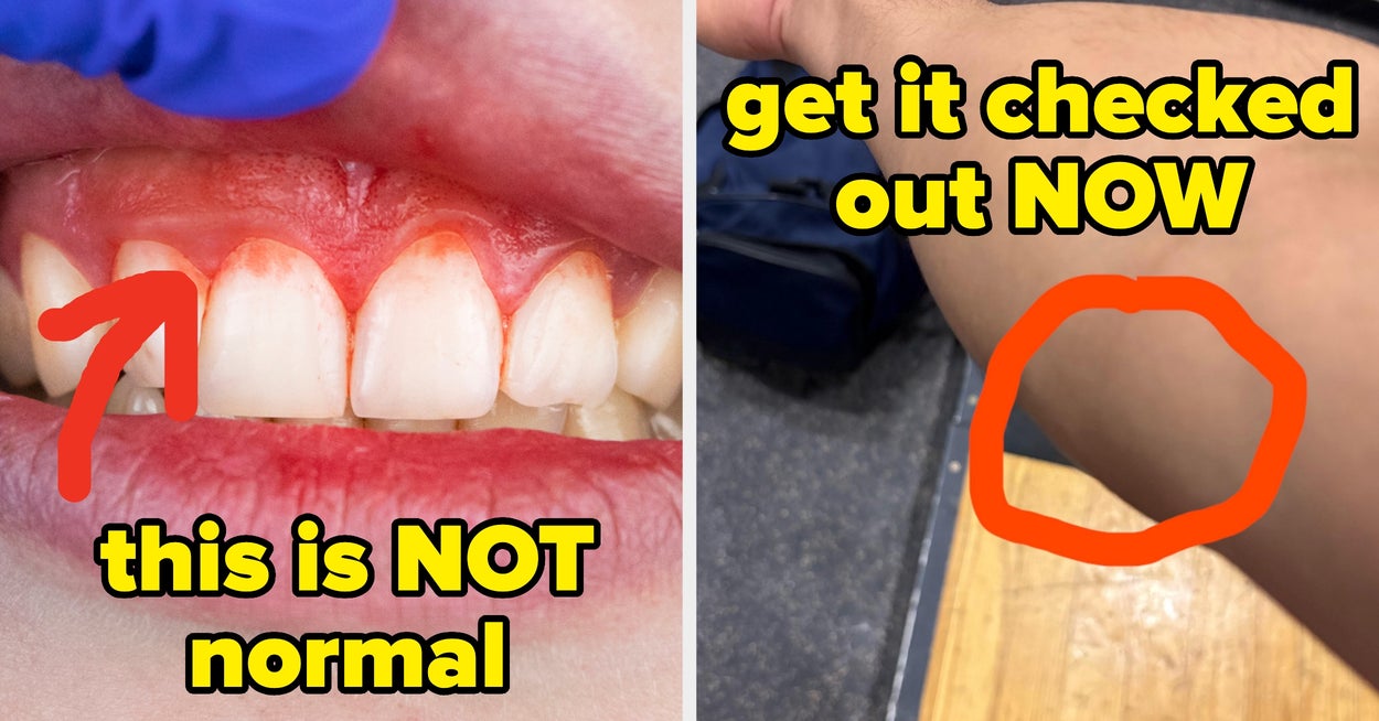 19 Doctors Share Health Signs You Shouldn't Ignore