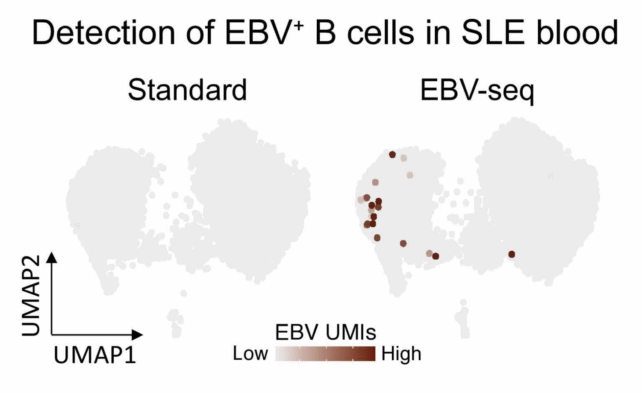 EBV B cell
