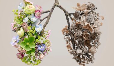 Lung Cancer In Women Is Often Overlooked. Here Are the Symptoms You Should Know