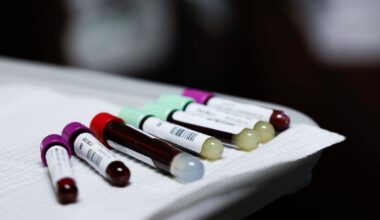 Dallas scientist wins award from American Heart Association for genetic discovery