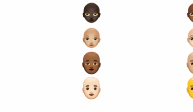 Are you balding? There’s an AI for that