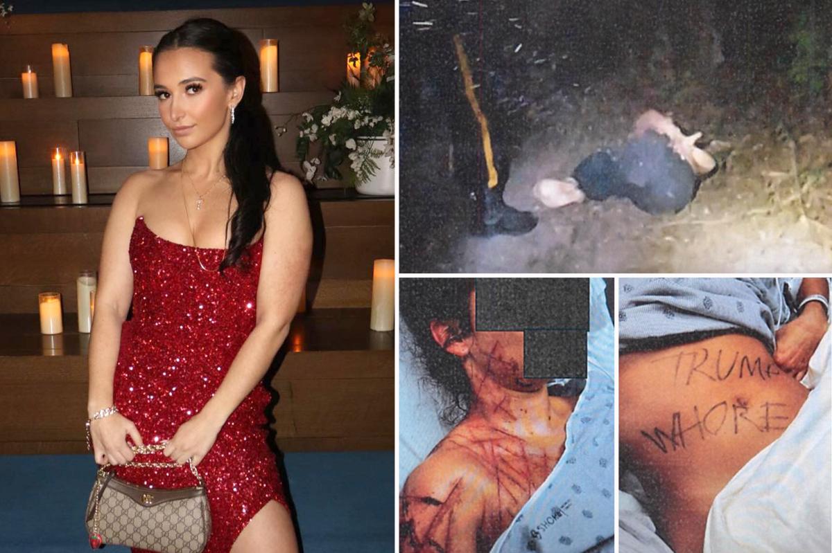 Ex-GOP aide paid fetish artist to mutilate her, claimed it was an anti-Trump attack: docs