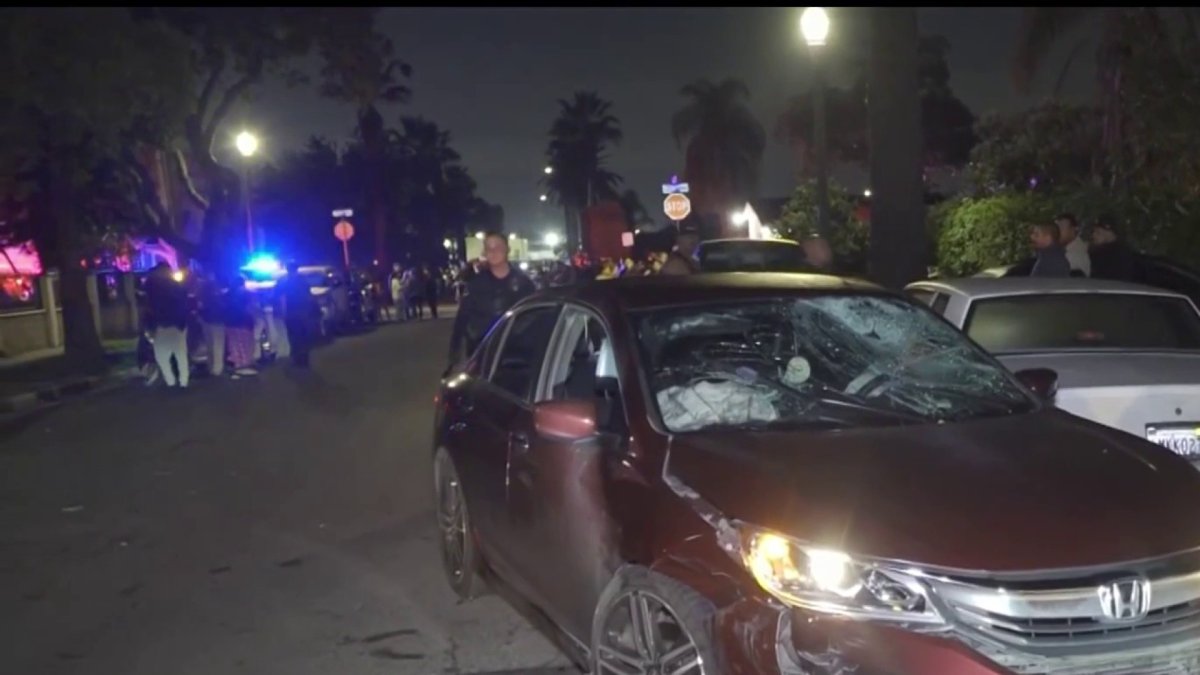 Child recovering after hit and run in Anaheim – NBC Los Angeles