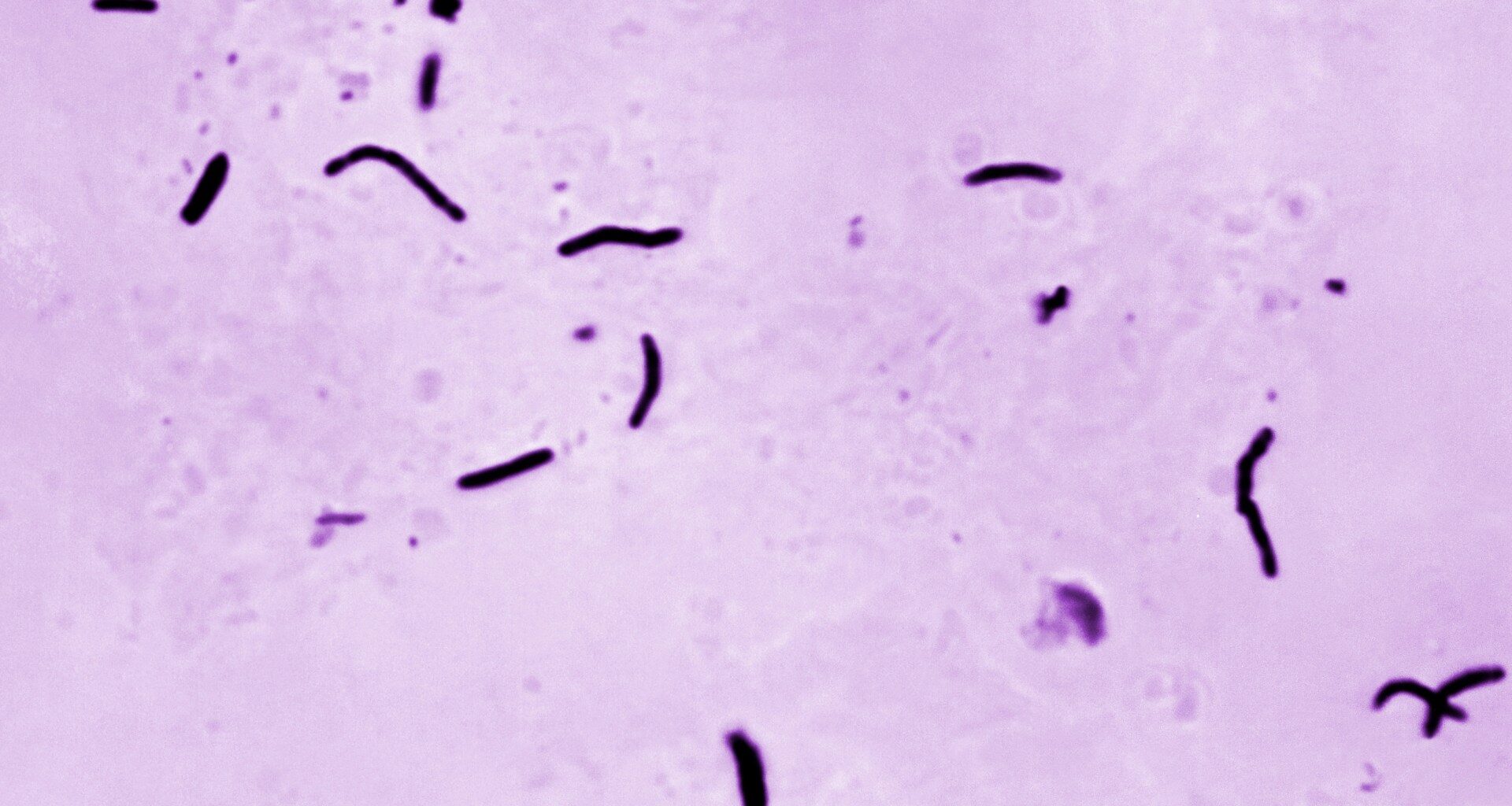 Tuberculosis kills 1.23 million people last year, WHO says | World Health Organization News