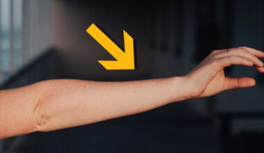 Human Arms Keep Growing an Extra Artery, Showing We're Still Evolving : ScienceAlert