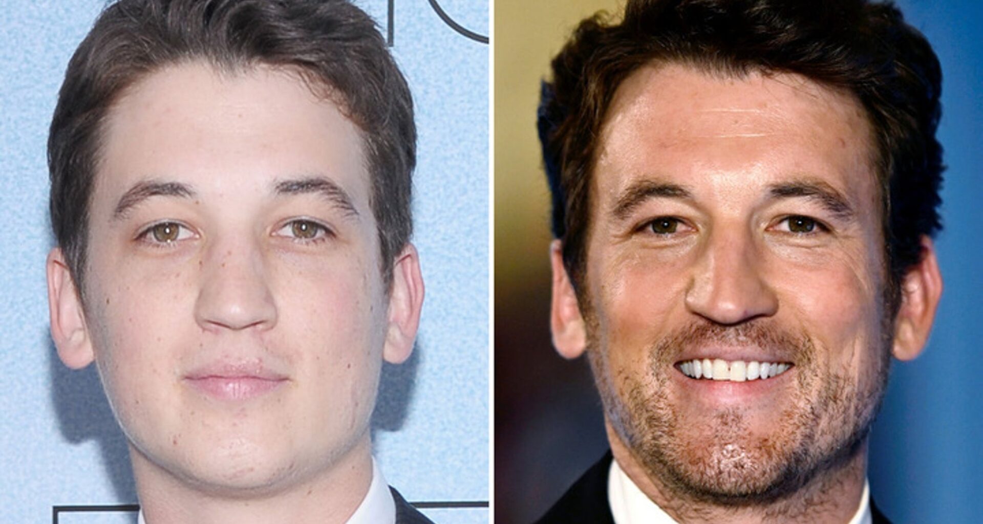 Miles Teller -- Good Genes or Good Docs?!