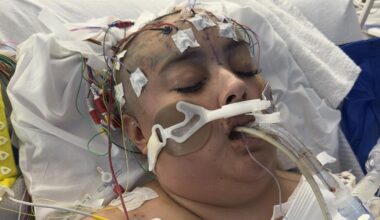 Hit-and-run horror: Family says tire marks found on victim’s back