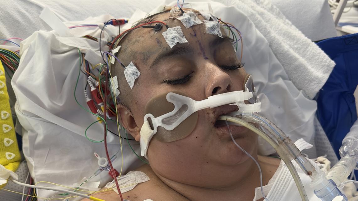 Hit-and-run horror: Family says tire marks found on victim’s back