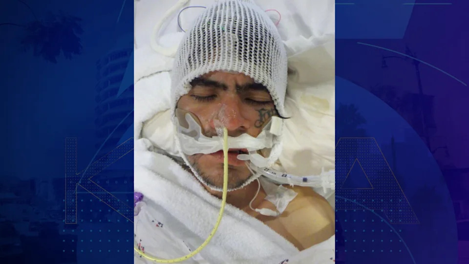 A male patient around 35 years old was found injured on Daly Street in the Lincoln Heights neighborhood of L.A. on Oct. 27, 2025. (Los Angeles General Medical Center)