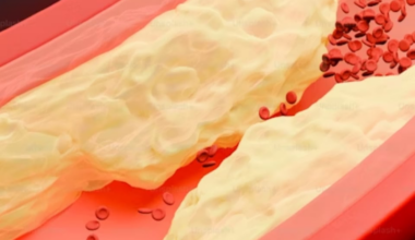 8 foods known to bring down cholesterol levels naturally - The Indian Express