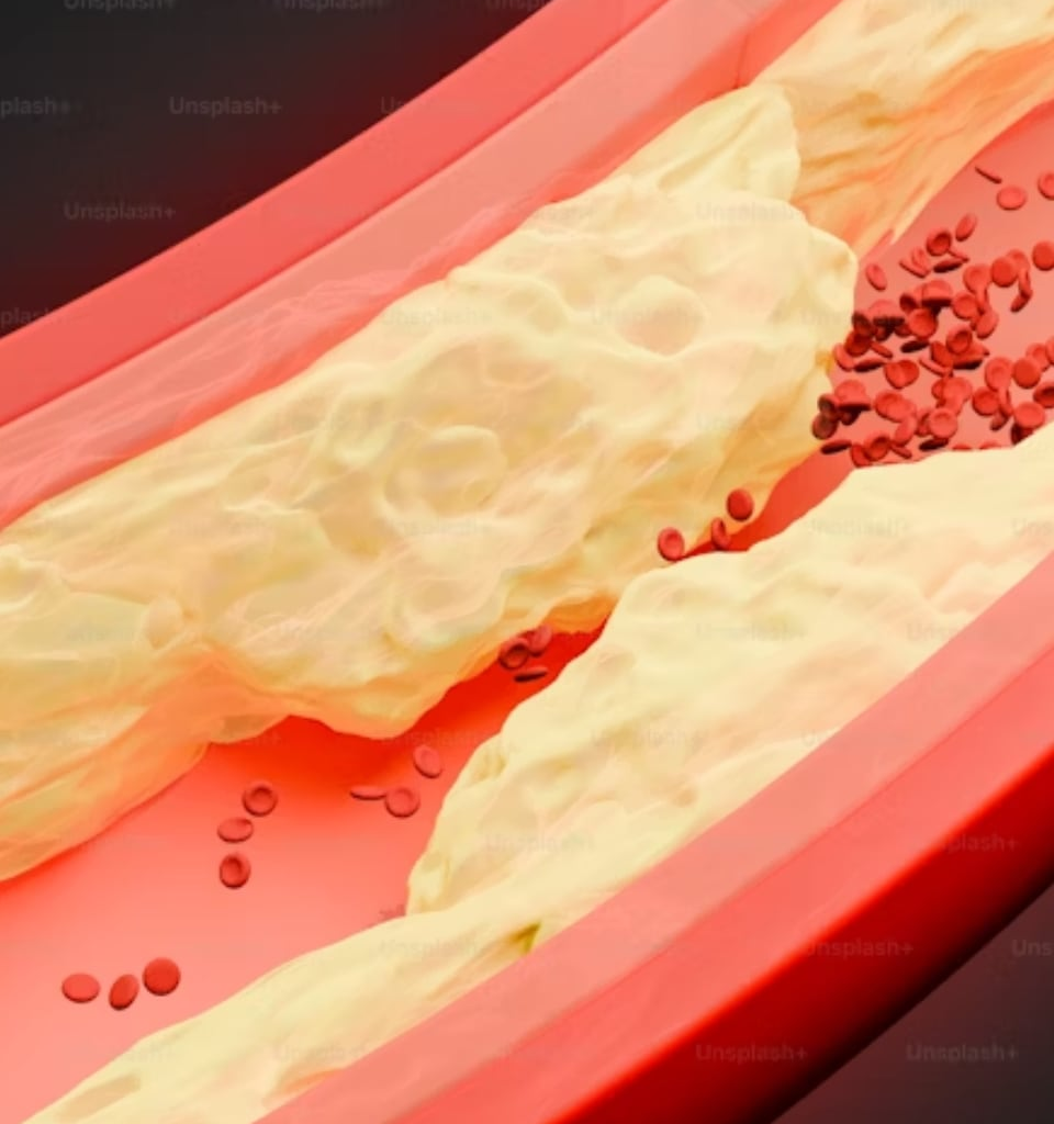 8 foods known to bring down cholesterol levels naturally - The Indian Express