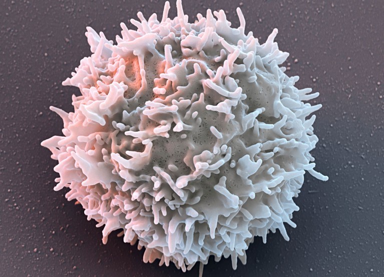 A coloured scanning electron micrograph image of a single chimeric antigen receptor T-cell, an organic white blob with a surface covered in short tendrils.