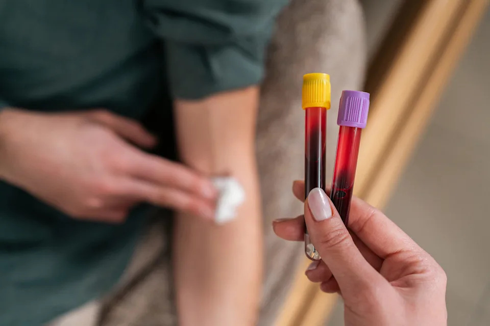 Is the Galleri blood test the future of cancer treatment? It's not that simple. The new research from the company, while promising, isn't some cure-all.