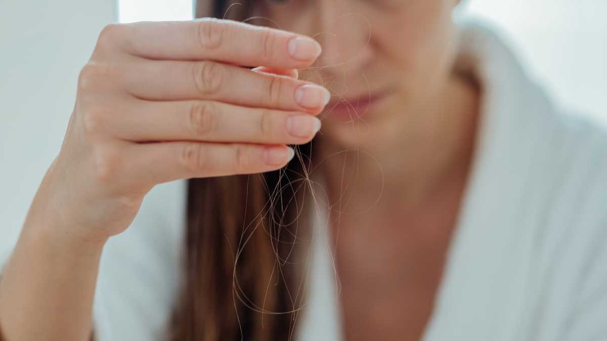 Dermatologist warns hair loss as side effect of GLP-1meds